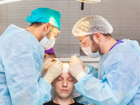 De Beste Klinieken Voor Haartransplantatie