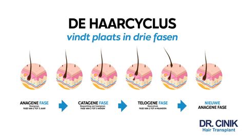 Haartransplantatie Voor Dummies: Een Gids Voor Beginners